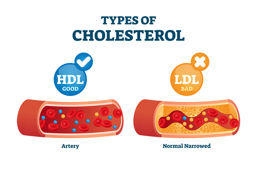 Eggs and Cholesterol